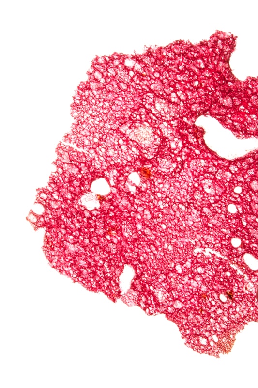 component image
